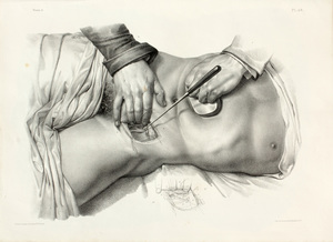 Nicolas Henri Jacob (1782-1871): Anatomical Images